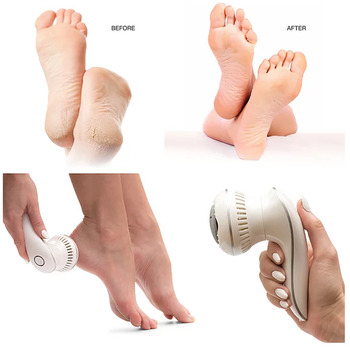Spa Pedi Hard Skin Remover - Odstraňovač mozoľov
